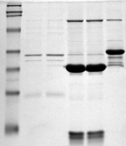 Expression of Soluble Proteins in E. coli