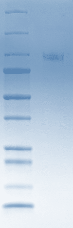 Tamm Horsfall Glycoprotein