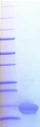 Andes Virus Nucleoprotein (Immunodominant Region, Recombinant)