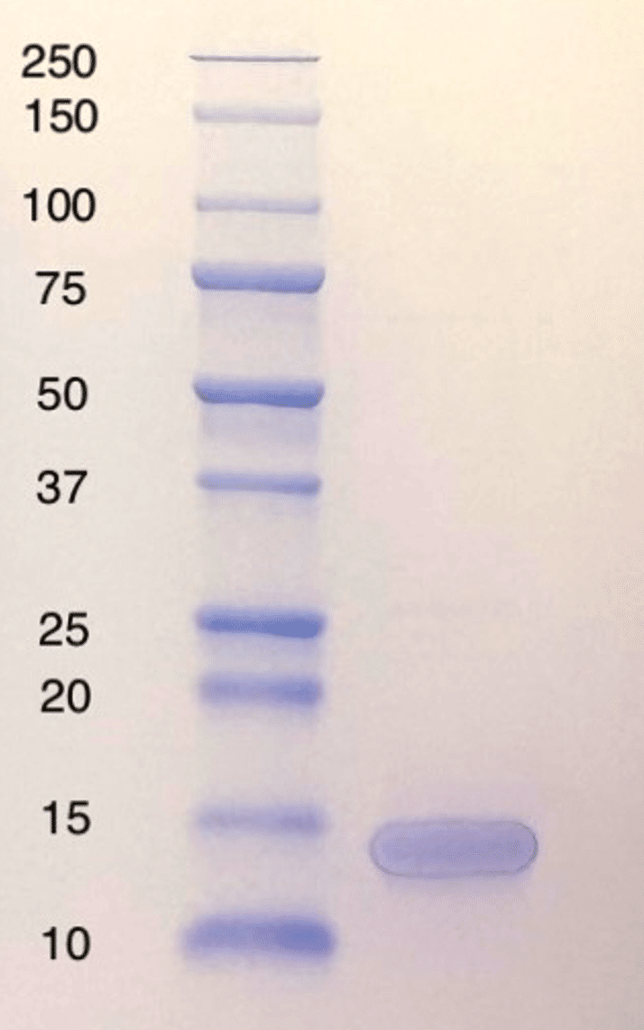 Bundibugyo virus Nucleoprotein (C-terminal Domain, Recombinant)