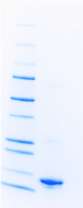 Bundibugyo virus Nucleoprotein (C-terminal Domain, Recombinant)